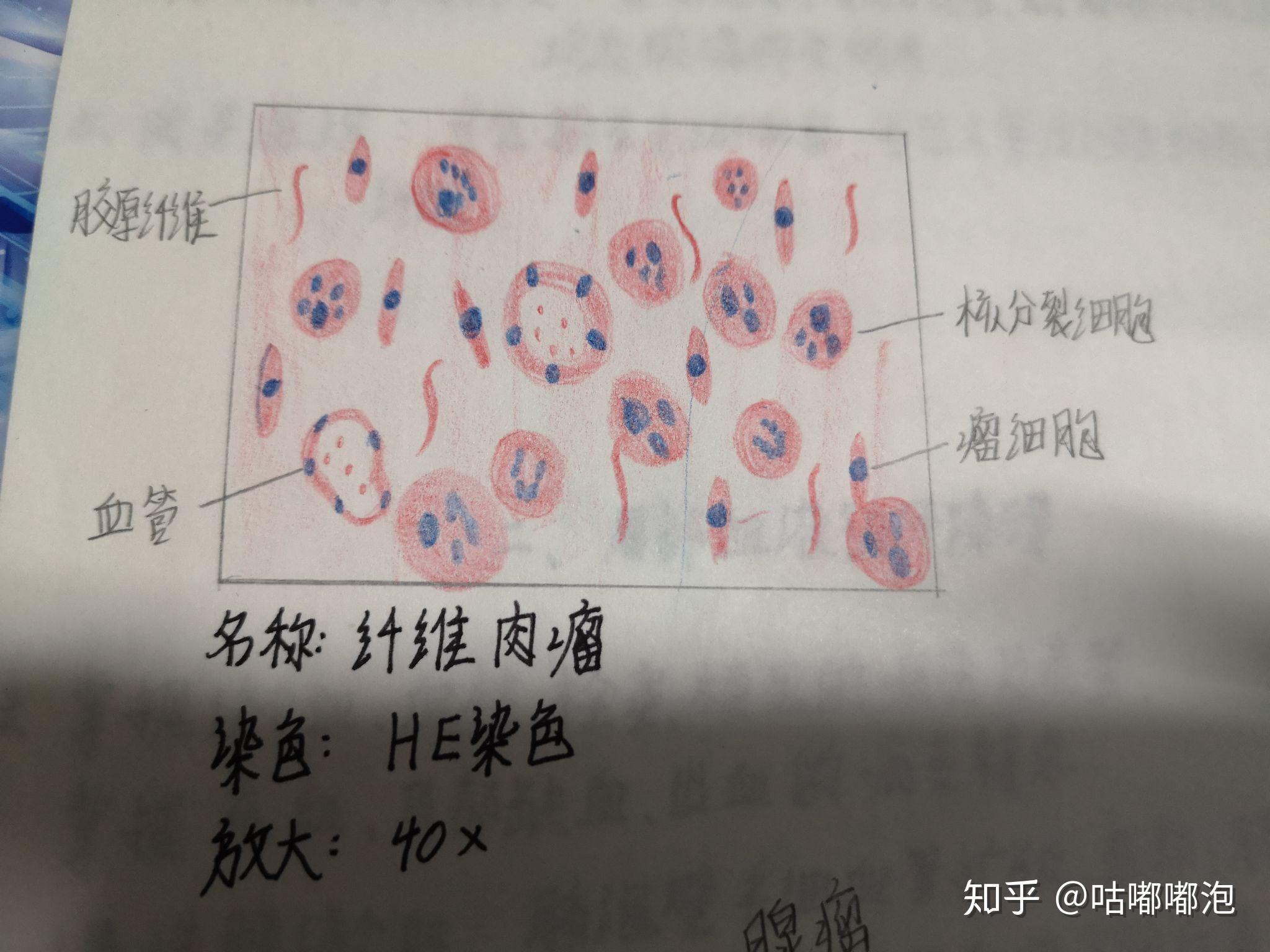 成熟单核细胞手绘图图片