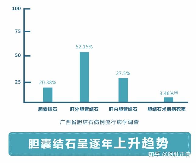 喀斯特地貌的广西省1981年-1999年间胆结石病例