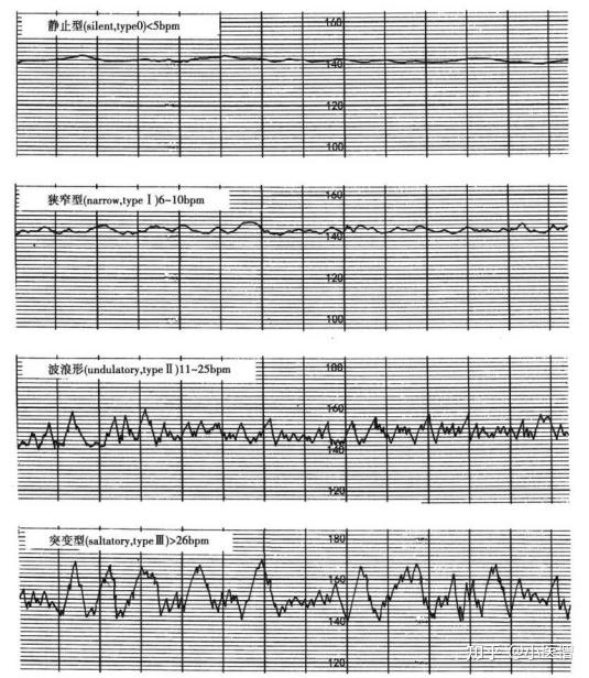 孕期监护 - 知乎