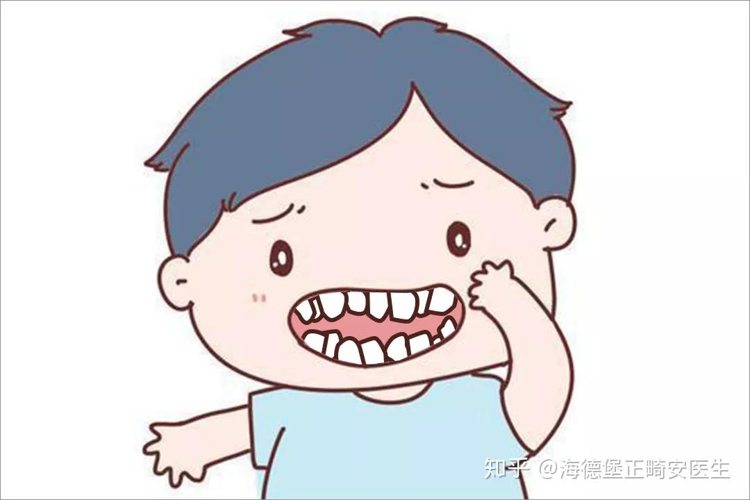 答疑宝贝乳牙不齐有缝隙地包天什么时候治疗合适