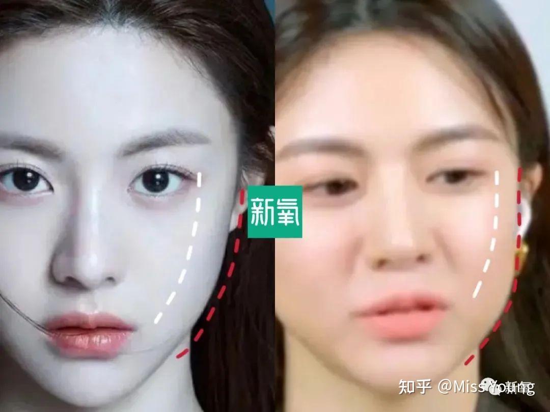又一个整形模板垮的不忍直视? - 知乎
