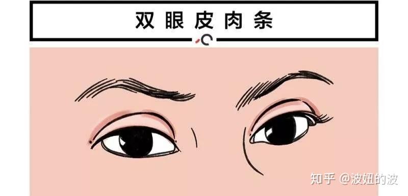 什么是双眼皮肉条感 v2-87d71a6d454a6020d216249ca96b0a93_r.jpg