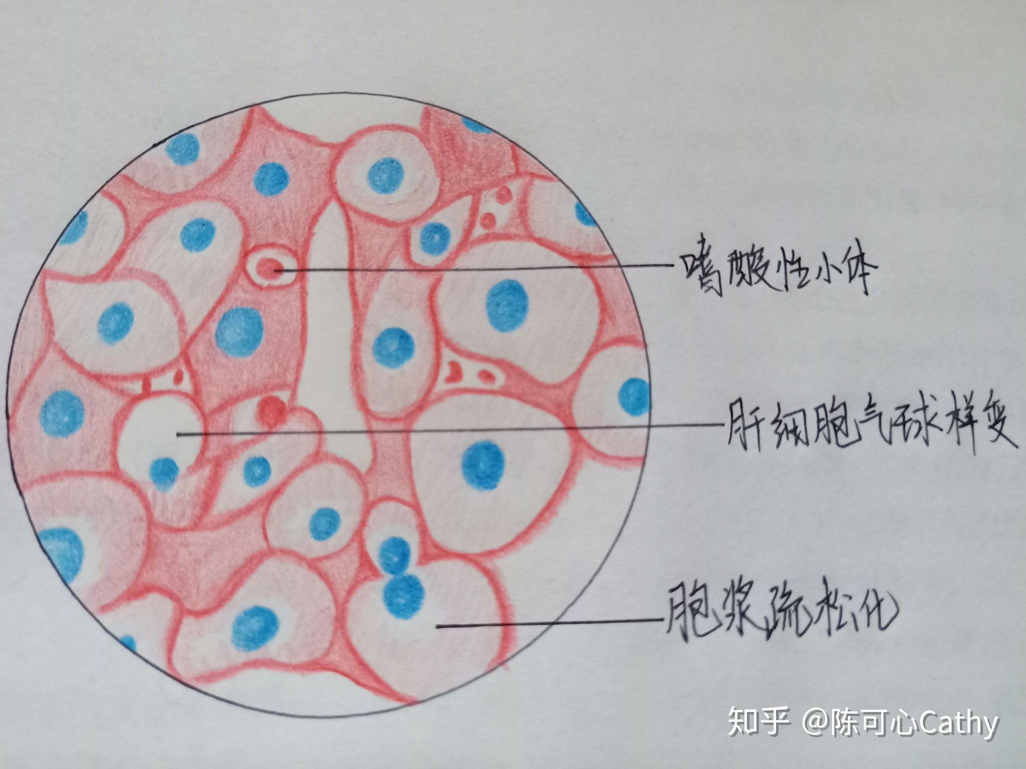 肝细胞图片手绘图片