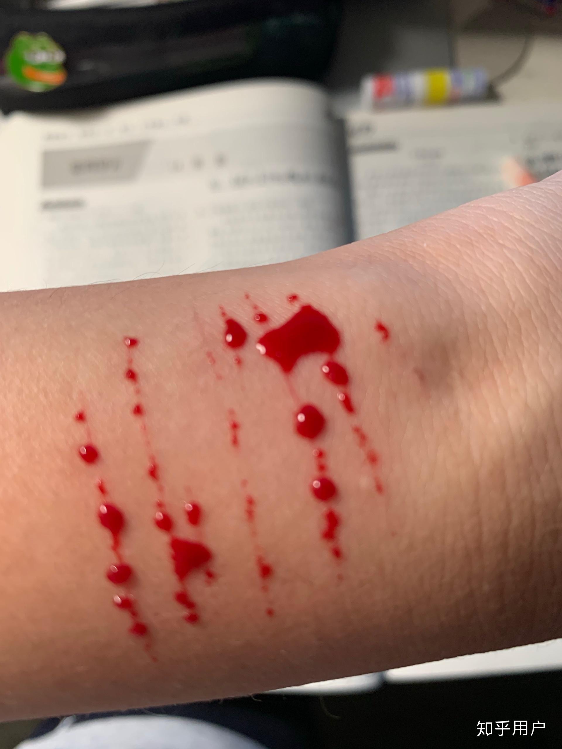 自残属于什么心理