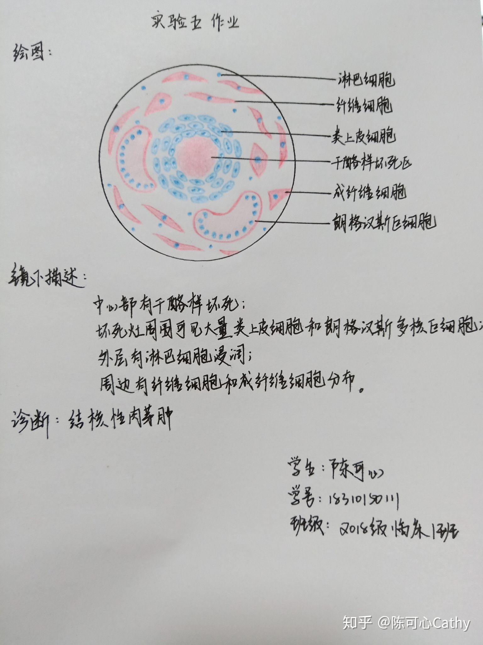 病理学红蓝铅笔绘图实验作业