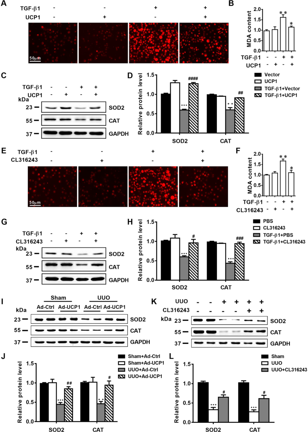 『CKD治疗新靶点』武汉协和医院张春教授团队揭示UCP1缓解肾间质纤维化进展的机制！ - 知乎