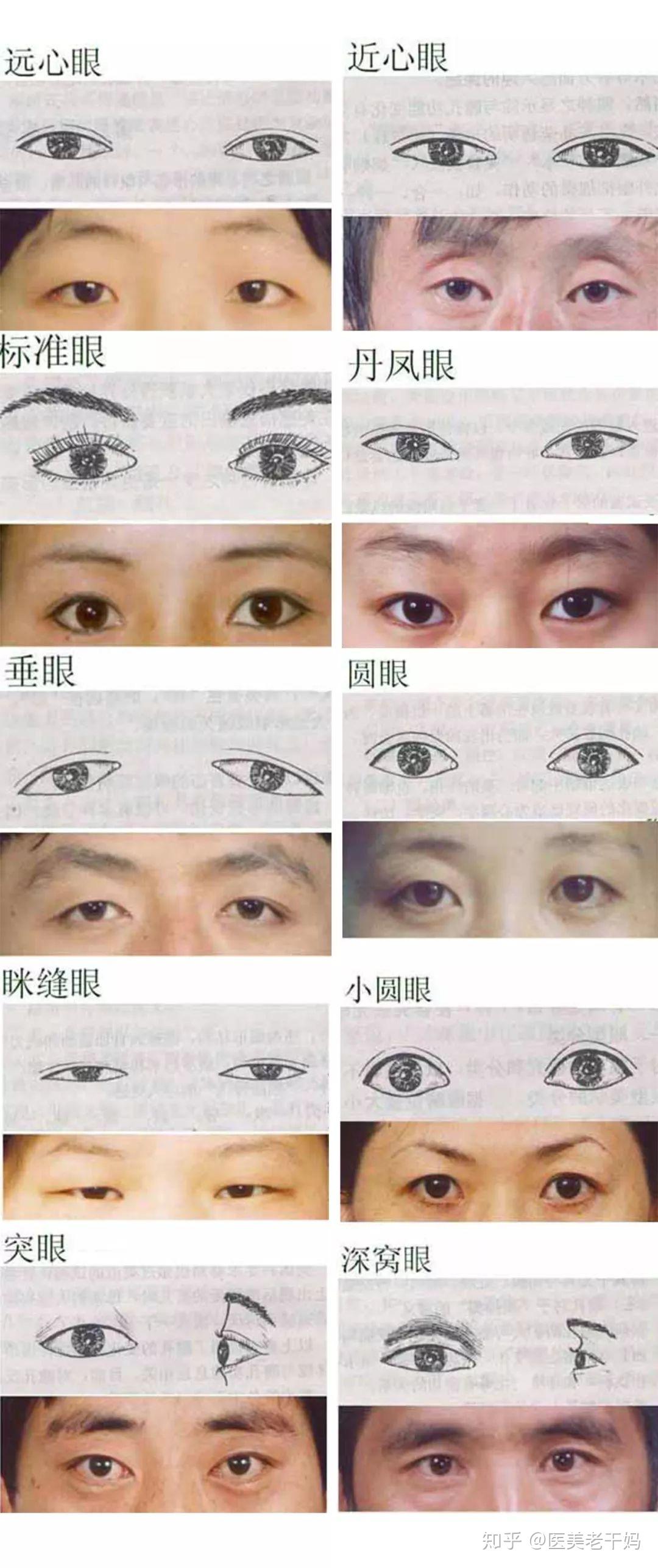 深圳双眼皮手术多少钱？ - 知乎