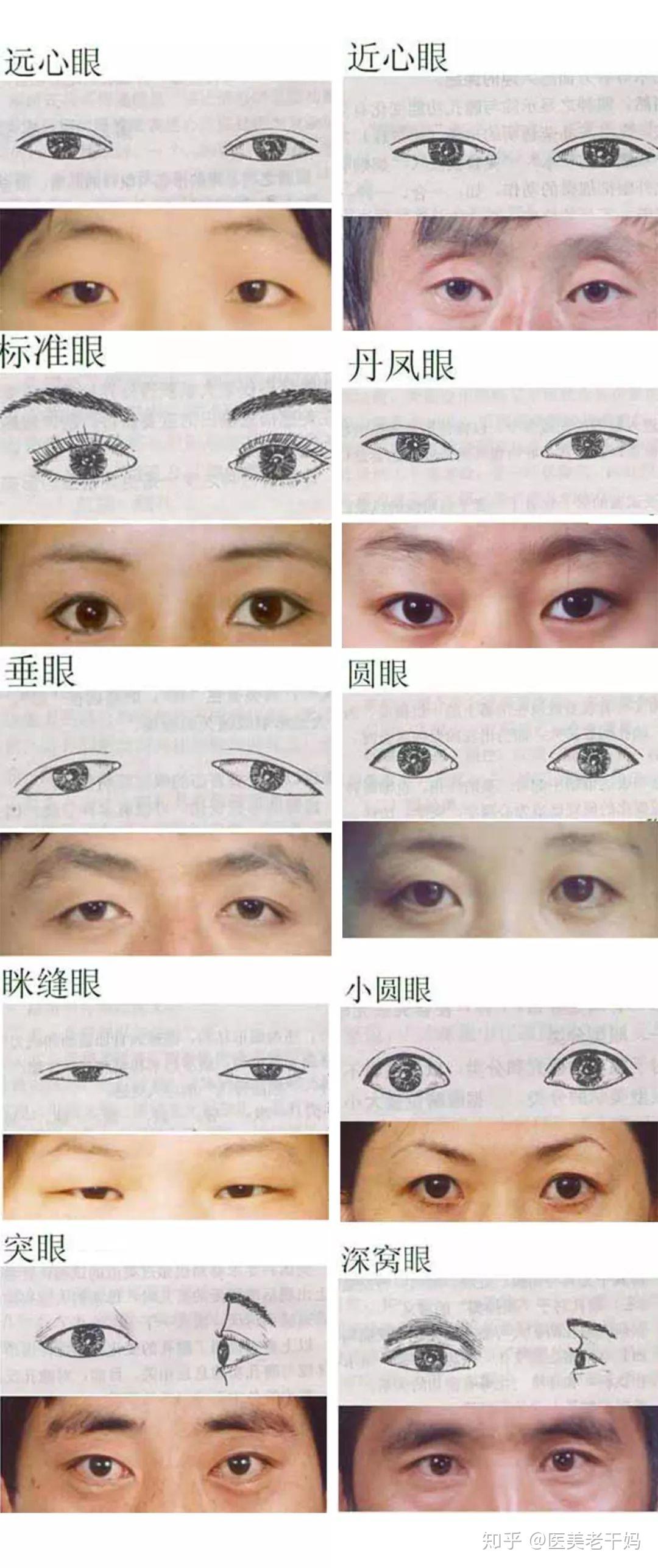 眼部整形美容——眼部混搭重塑，拯救四种眼部问题！_手术