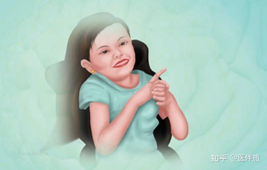Rett综合征 zhuanlan.zhihu.com