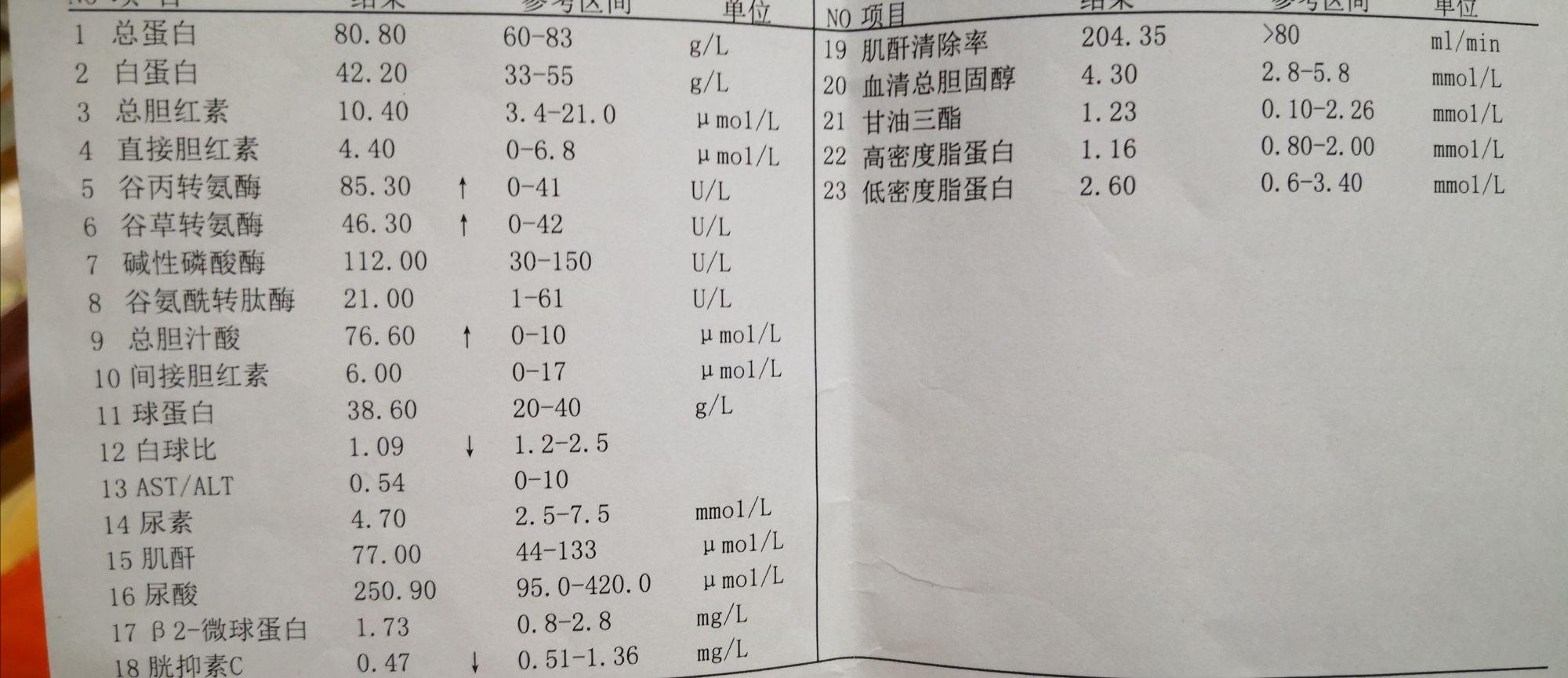 v2-888cce50c2f21fba8c05ec21af8e943b_r.jpg