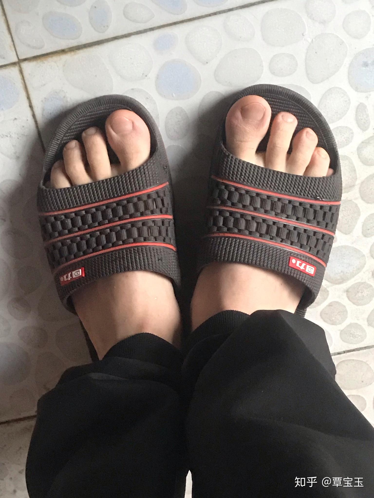 女生脚丑是种什么样的体验? - 知乎