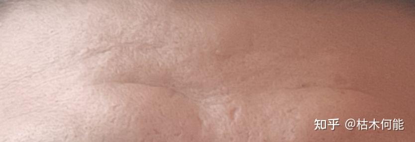 枯木先生的生活指南(皮肤篇)密集恐惧症患者勿进