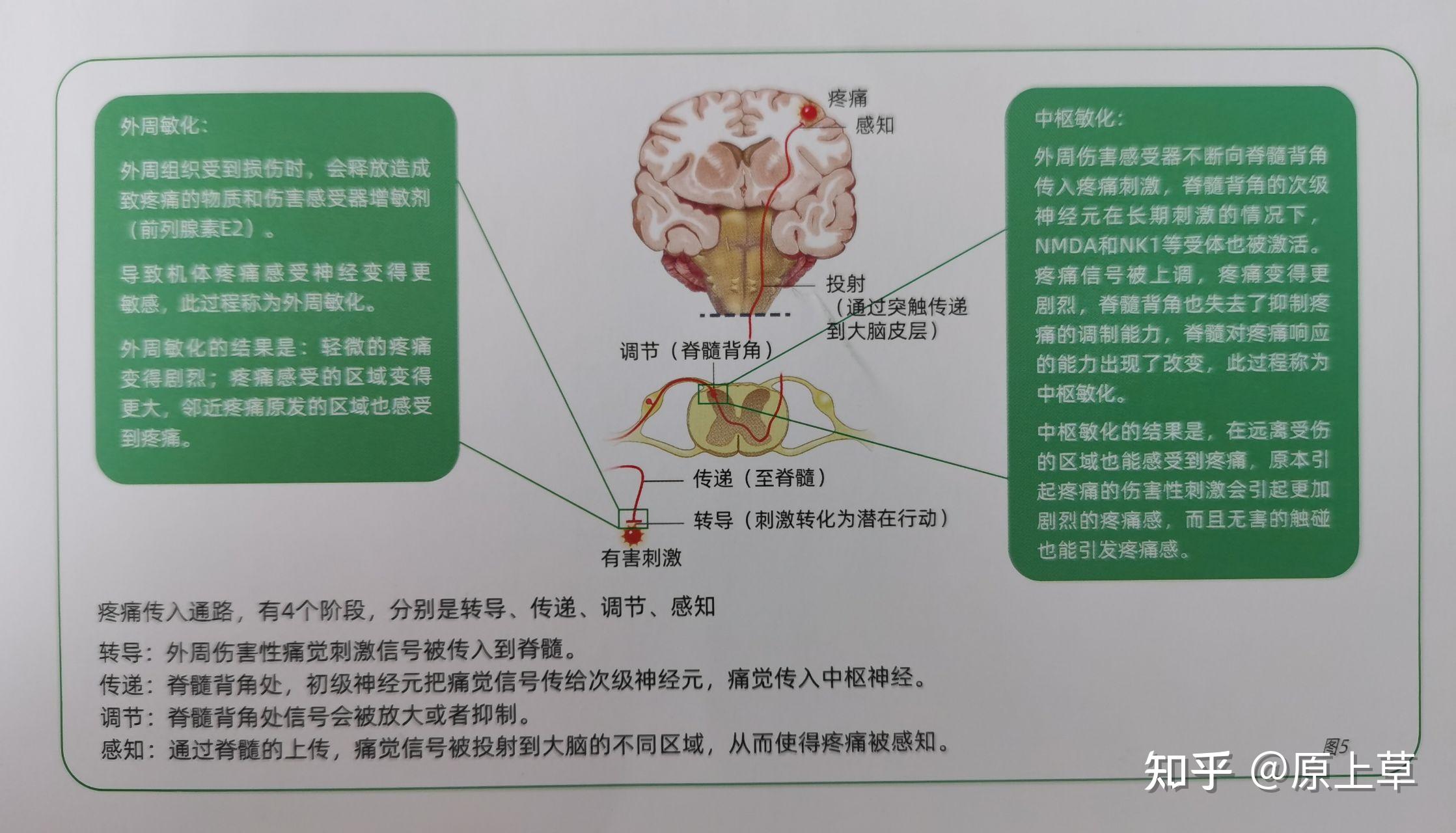多模式镇痛鉴于疼痛的多样性及疼痛传导通路的阶段性,任何一种单一