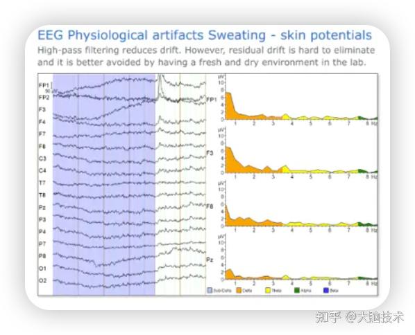 常见EEG伪迹波形图（基于analyzer分析软件展示） - 知乎