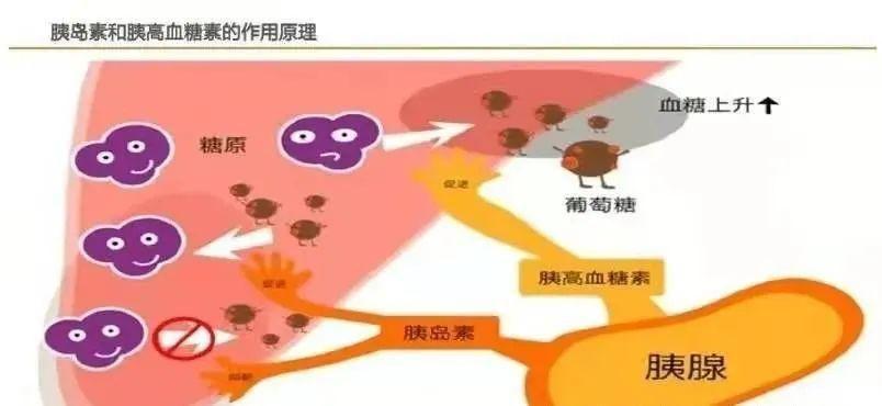 糖尿病的形成原因和你想的不一样你信谁