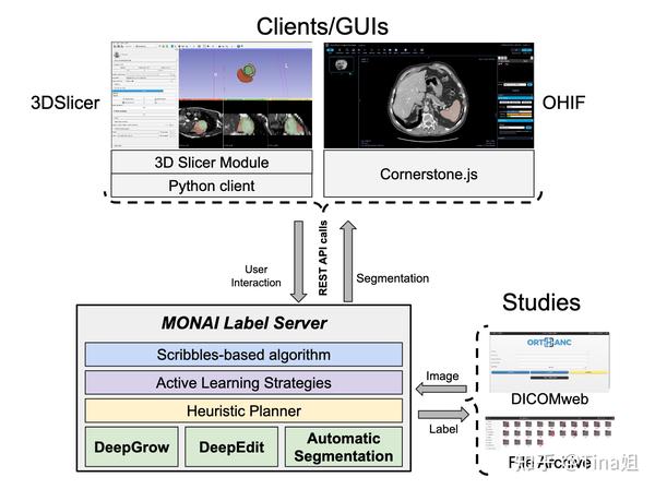【论文阅读】MONAI Label：人工智能辅助的 3D 医学图像交互式标注框架 - 知乎