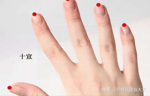 手指麻木是颈椎病的信号不同手指对应了不同椎节的压迫