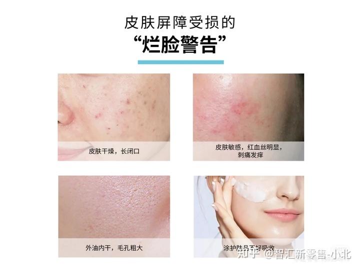 2使用过热的水温进行清洁1使用含有酒精的产品三【导致皮肤屏障受损