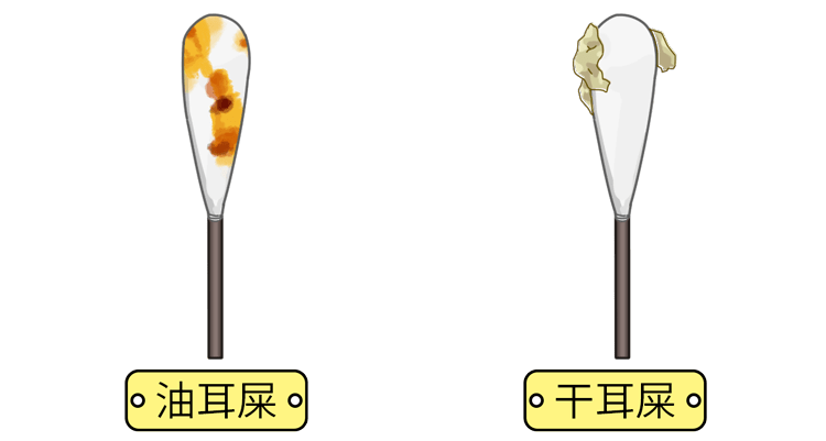 可分为干性耵聍和油性耵聍,分别对应我们常说的干耳和油耳,当然也有人