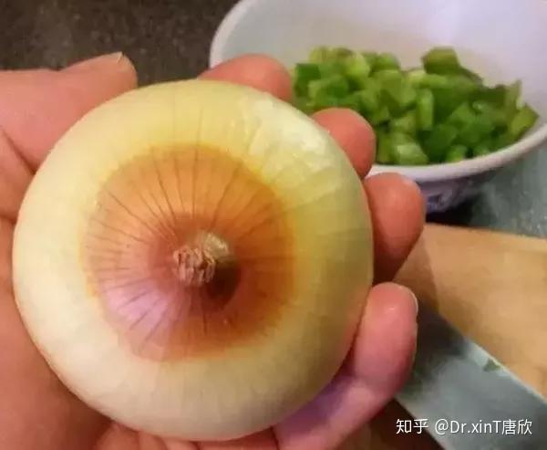 乳头颜色变深要警惕