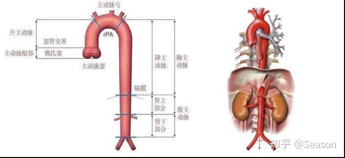 重疾理赔解释25——主动脉手术