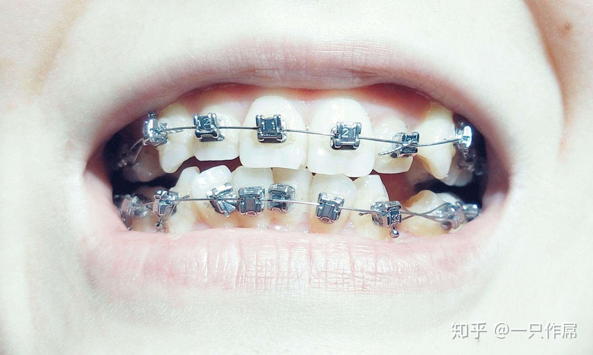 v2-8afd711f5040e986a4d7616a3faceebb_r.jpg