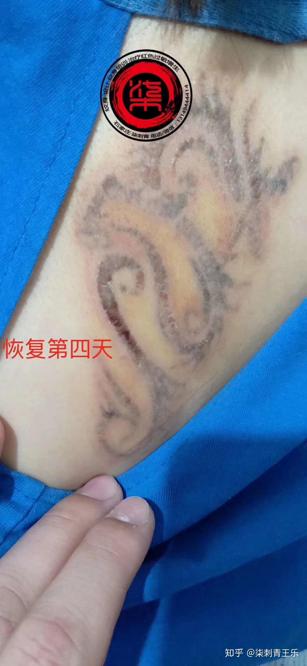上海洗纹身哪里更专业，上海一扇门洗纹身痛感低无疤痕更正规！_皮肤_客户_技术