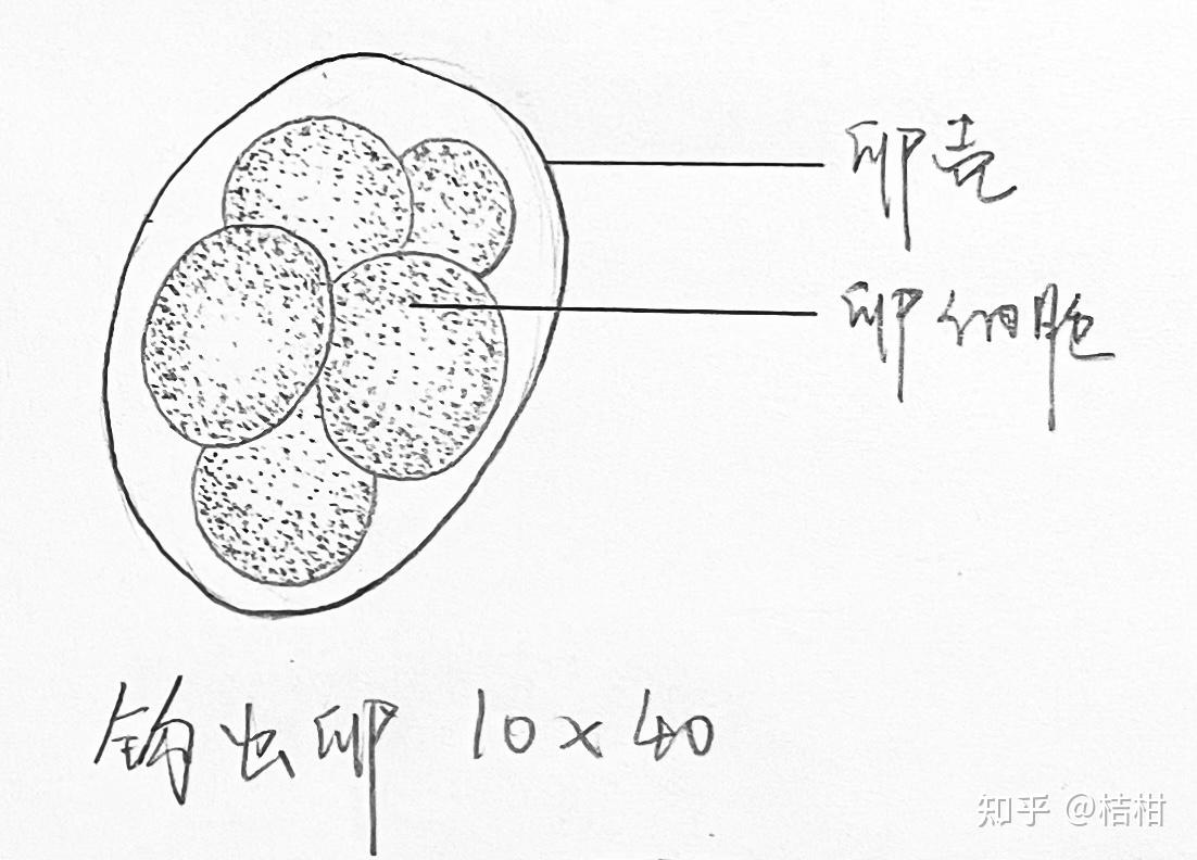 [人体寄生虫][标本手绘]受精蛔虫卵,未受精蛔虫卵,鞭虫卵,钩虫卵,蛲虫