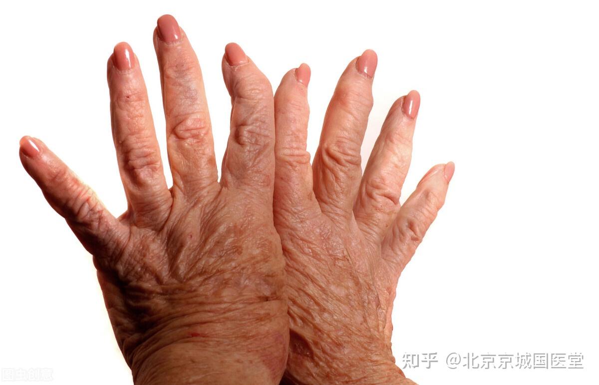 骨癌早期有哪些症状?如何发现早期骨癌?医生告诉您 - 知乎