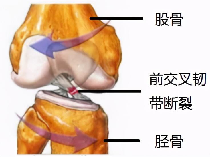 十字韧带的位置图片