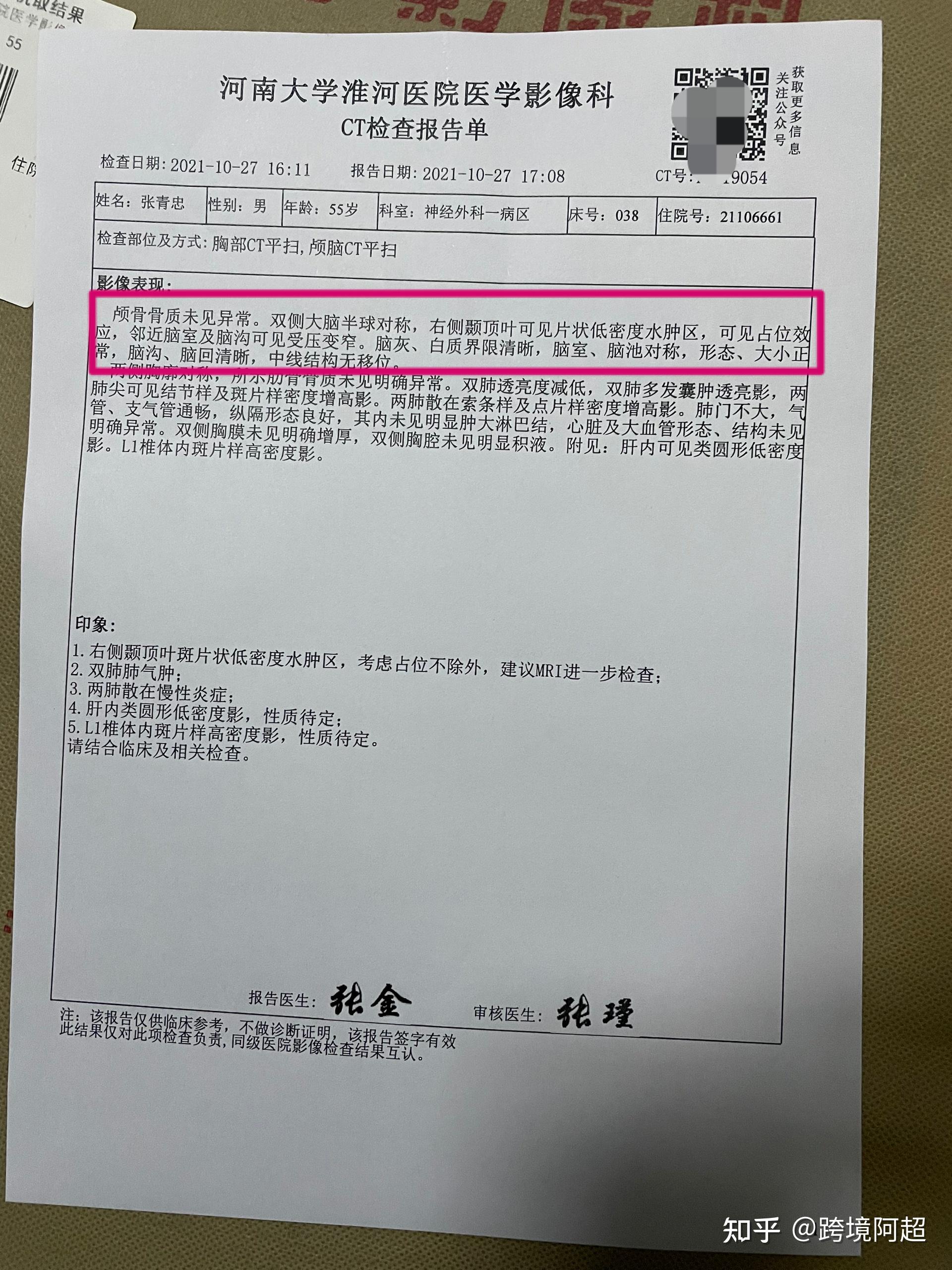 恶性脑胶质瘤有多可怕?放化疗是为了治疗还是续命?