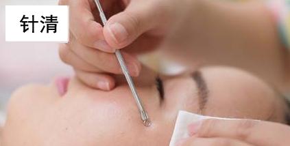 满脸闭口要不要针清呢关于针清看这篇文章就够了