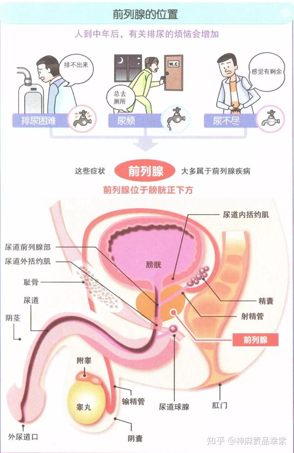 神麻贡品尿频尿急但尿量不大是什么原因呢