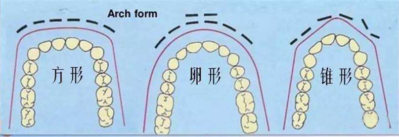 牙弓是决定颜值的一大要素 知乎