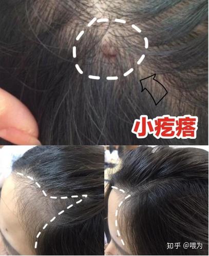 v2-8c4a270c082a3a2627cae3e9ae5fe3c3_b.jpg