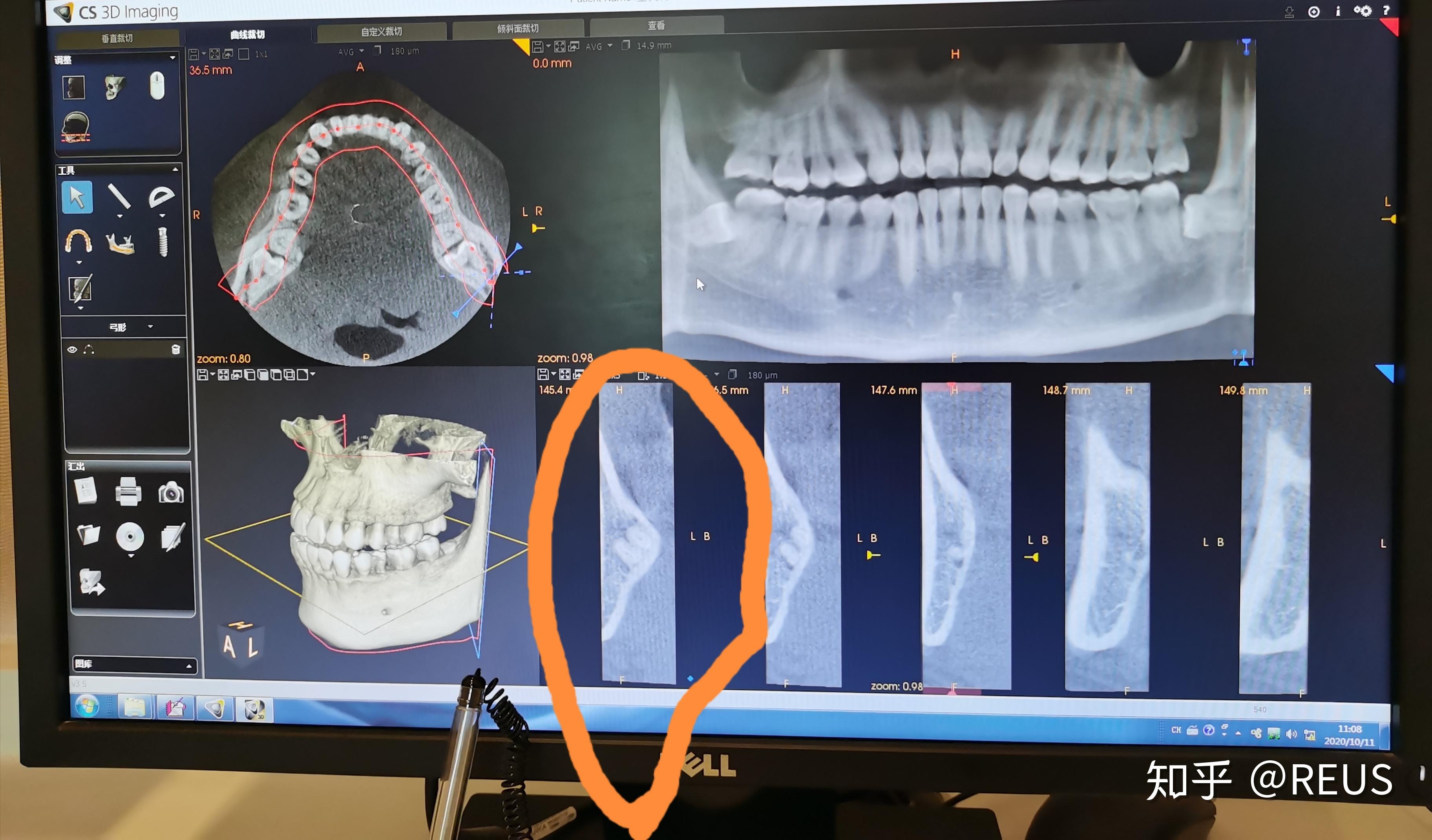 图3-49 上颌第三磨牙-口腔颌面及颈部临床解剖学-医学