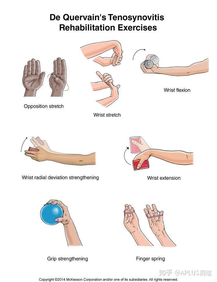 对于de quervains腱鞘炎,有一个很常见又简单的测试——finkelstein