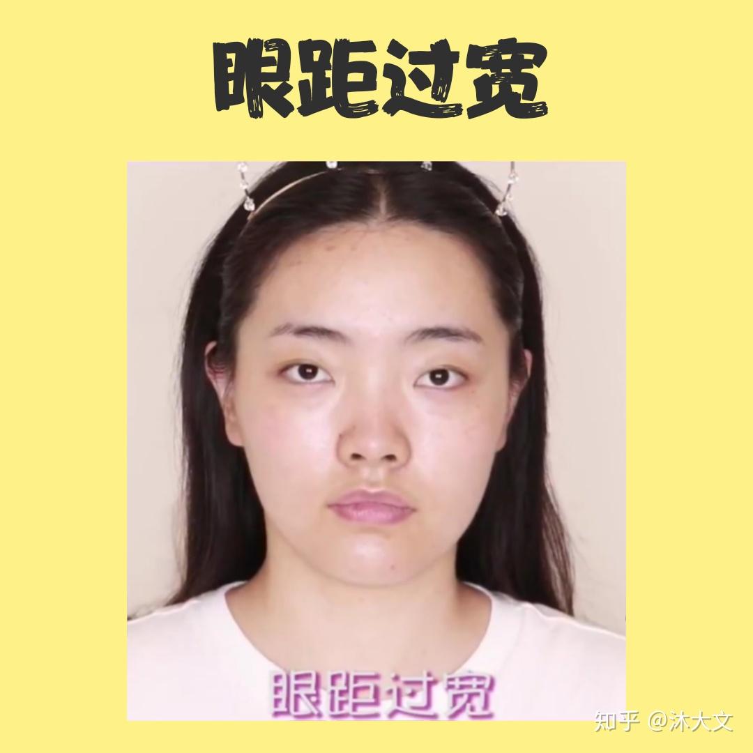 对于眼距太宽应该如何通过美瞳彩片和化妆修饰