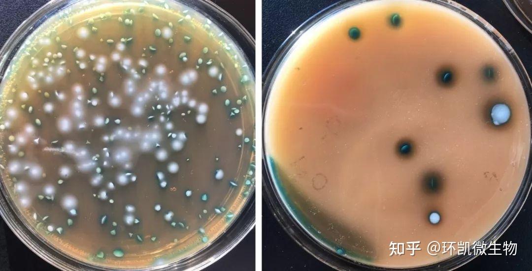 “肠道护卫菌”——双歧杆菌的分离、培养及鉴定分享 - 知乎