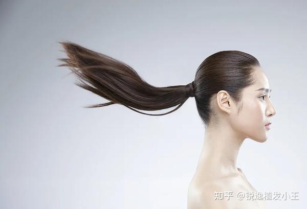 盘一盘,生活中几种常见发际线 - 知乎