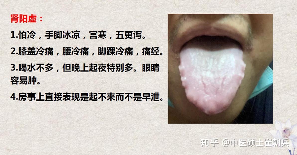 肾阴虚、肾阳虚、气虚、血虚症状和舌象都是什么样呢 - 知乎