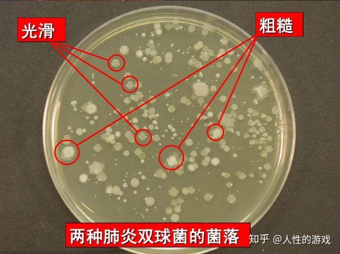 新型冠状病毒46细胞因子s型r型菌落多糖