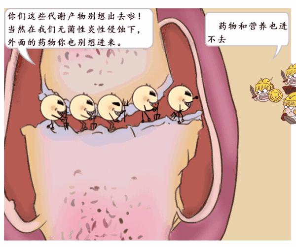 图解无菌性炎症侵蚀关节过程