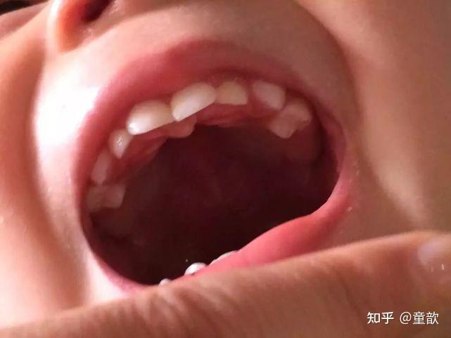 婴儿开始长牙齿的图片图片
