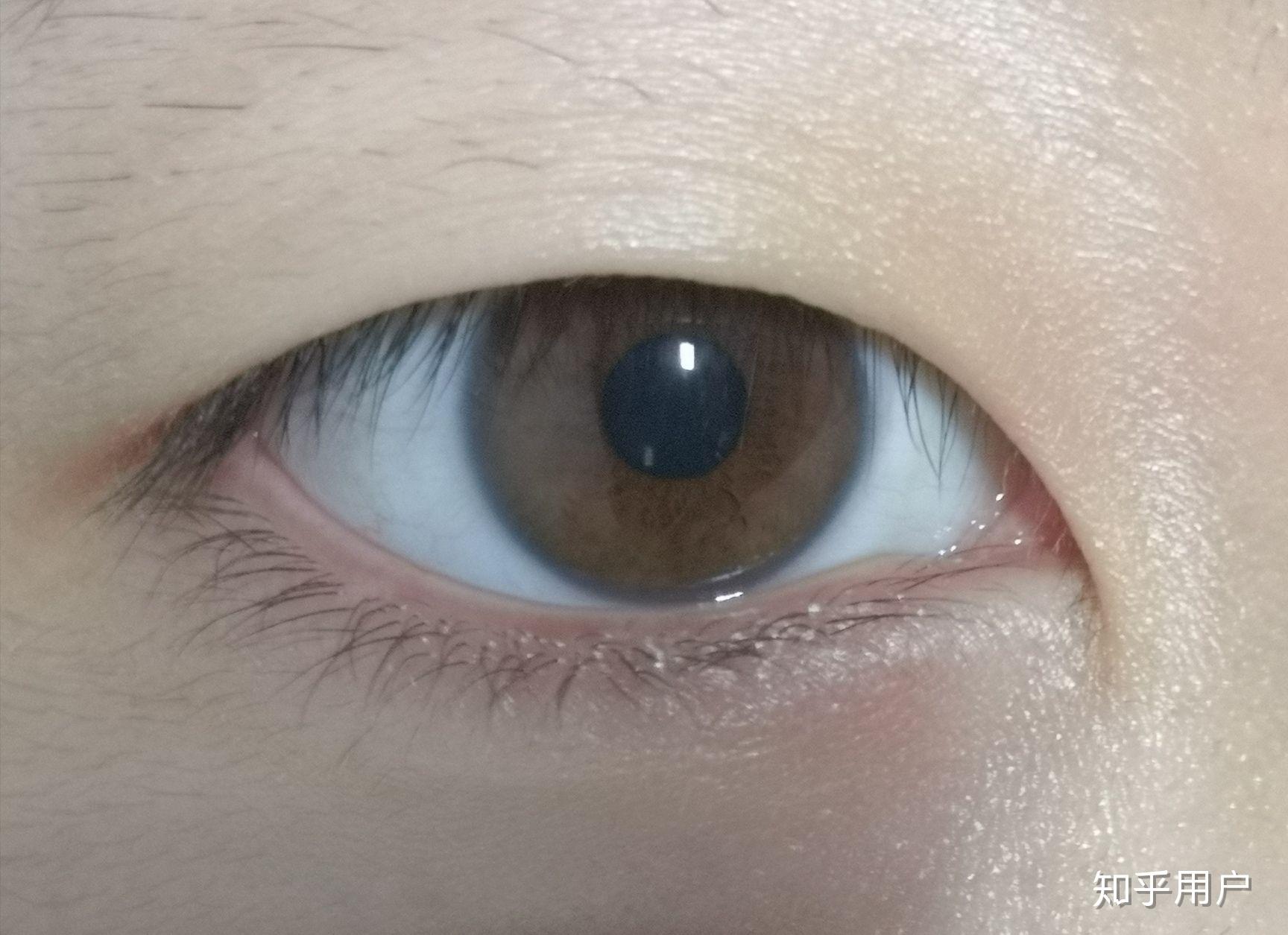 瞳色浅是怎样的体验? - 知乎
