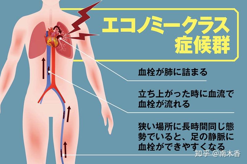 如何拉伸韧带又不伤身体 v2-8dc90ed90ce14727f5c4b65d488637ab_r.jpg