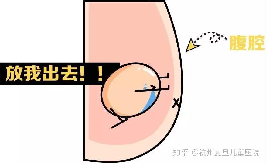 杭州复旦儿童医院冯志刚科普小儿隐睾手术最佳时间