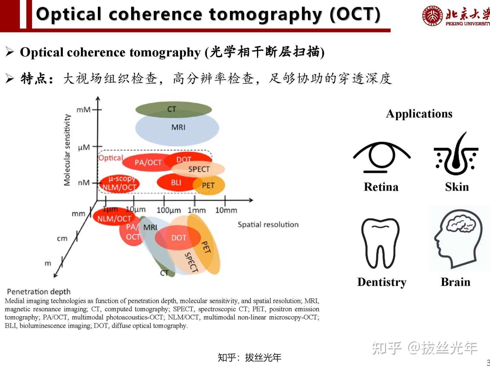 光学相干断层扫描:眼见为实 (Optical coherence tomography:Seeing is believing) - 知乎