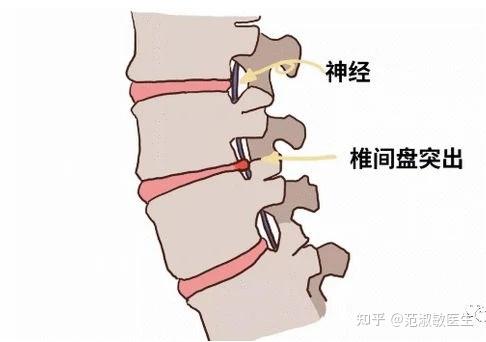 腰痛、背痛、肩膀痛、腿疼?介绍1个中药方,各种疼痛一扫光! - 知乎