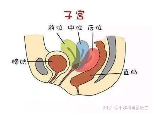 子宫前位与子宫后位 教你如何分清 知乎